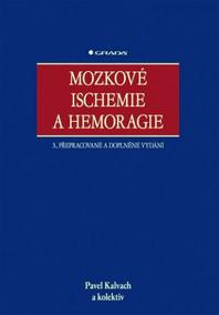 Mozkové Ischemie a Hemoragie