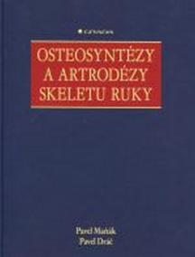 Osteosyntézy a artrodézy skeletu ruky