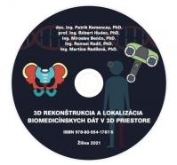 CD - 3D rekonštrukcia a lokalizácia biomedicínskych dát v 3D priestore