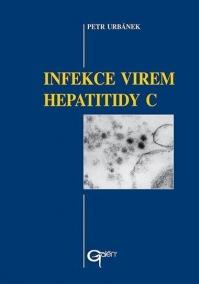 Infekce virem hepatitidy C