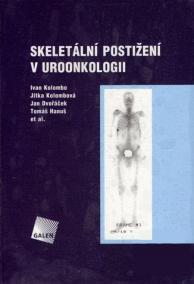 Skeletální postižení v uroonkologii