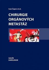 Chirurgie orgánových metastáz