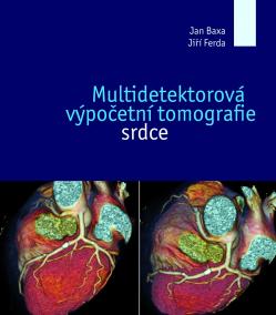 Multidetektorová výpočetní tomografie sr