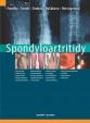 Spondyloartritidy