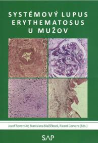 Systemovy lupus erythematosus u muzov